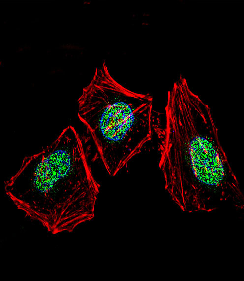 Ku70 Antibody in Immunocytochemistry (ICC/IF)