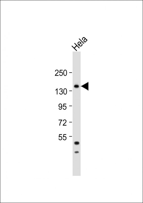 MTMR15 Antibody in Western Blot (WB)