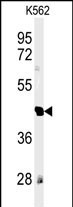 RTN4RL1 Antibody in Western Blot (WB)