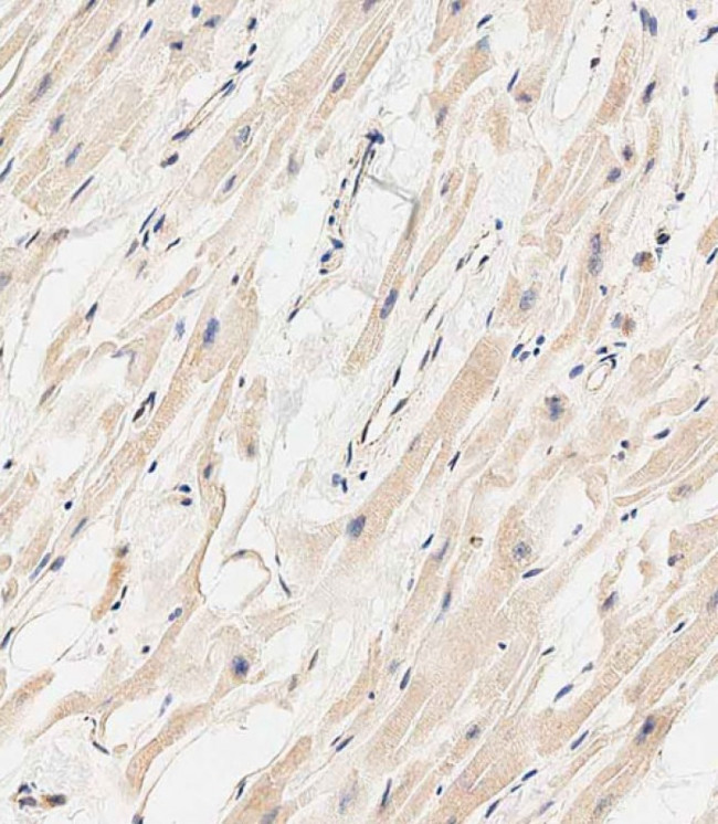 MARCH5 Antibody in Immunohistochemistry (Paraffin) (IHC (P))