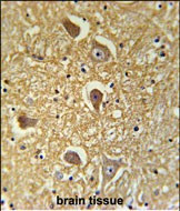 HAS2 Antibody in Immunohistochemistry (Paraffin) (IHC (P))