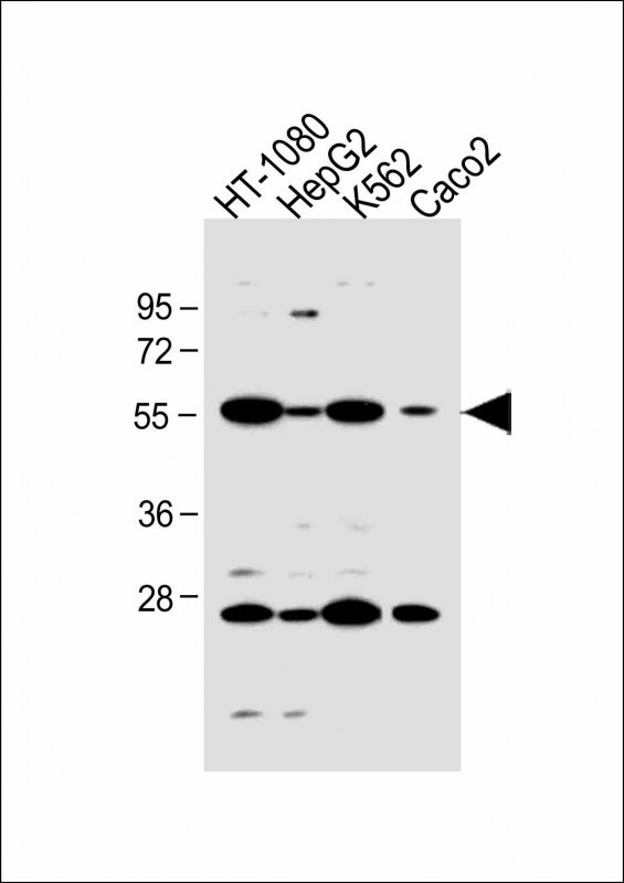 NTCP Antibody in Western Blot (WB)