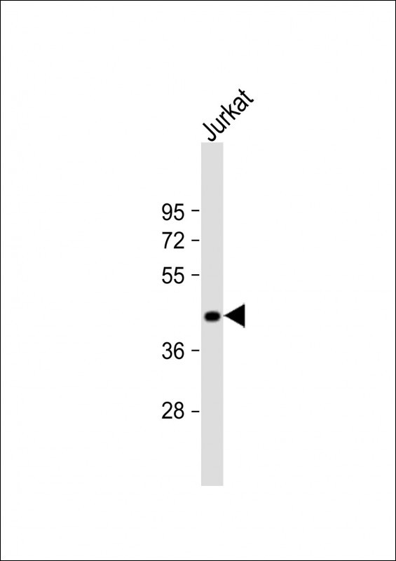 ST3GAL5 Antibody in Western Blot (WB)