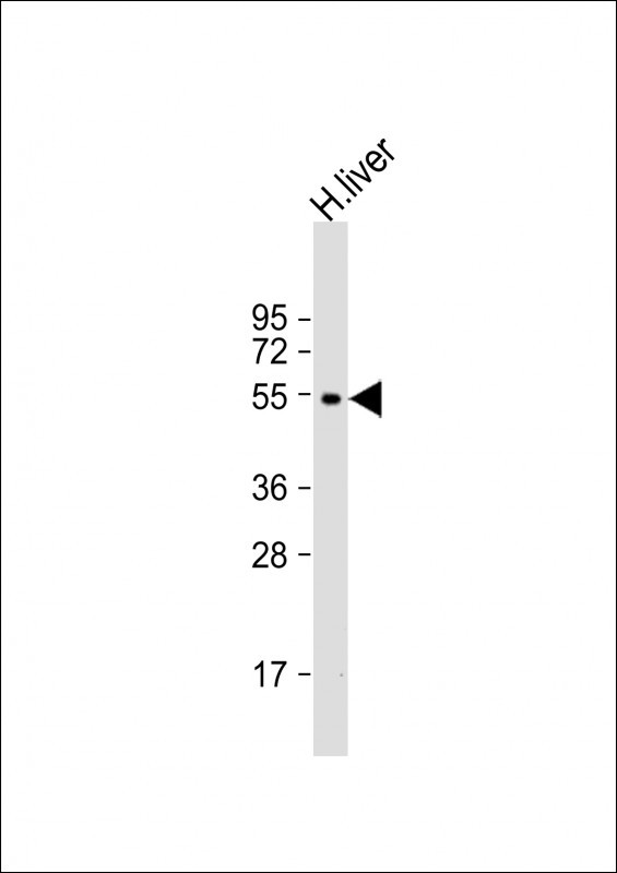 CYP2C19 Antibody in Western Blot (WB)