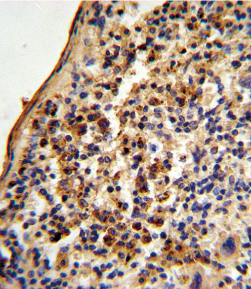 Ku70 Antibody in Immunohistochemistry (Paraffin) (IHC (P))