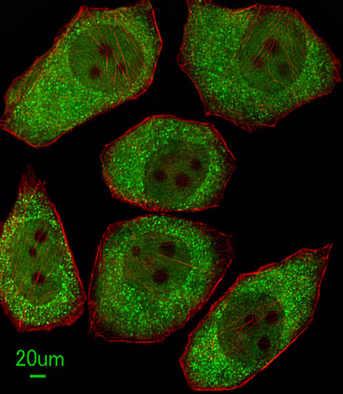 ALOX12 Antibody in Immunocytochemistry (ICC/IF)