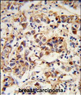 SPRR1B Antibody in Immunohistochemistry (Paraffin) (IHC (P))