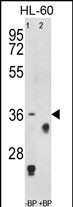 TNFRSF14 Antibody in Western Blot (WB)