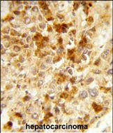 PEX2 Antibody in Immunohistochemistry (Paraffin) (IHC (P))