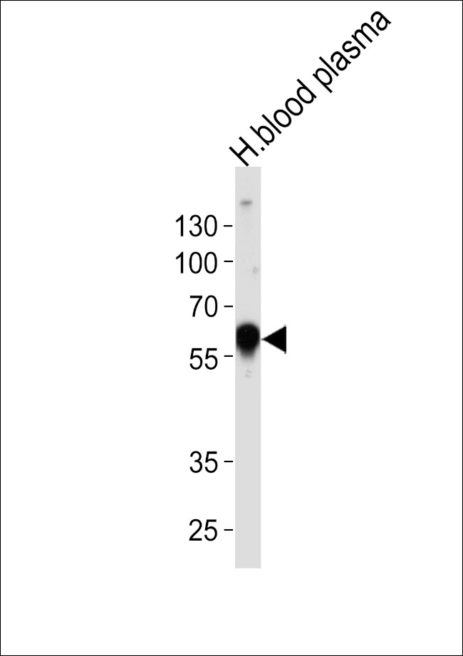 alpha-1 Antitrypsin Antibody in Western Blot (WB)