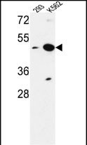 NUPL2 Antibody in Western Blot (WB)