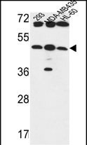 B3GNT5 Antibody in Western Blot (WB)