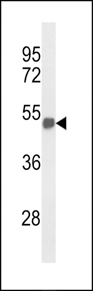 FOXG1 Antibody in Western Blot (WB)