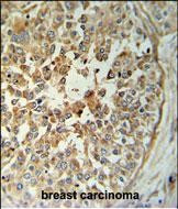 STING Antibody in Immunohistochemistry (Paraffin) (IHC (P))