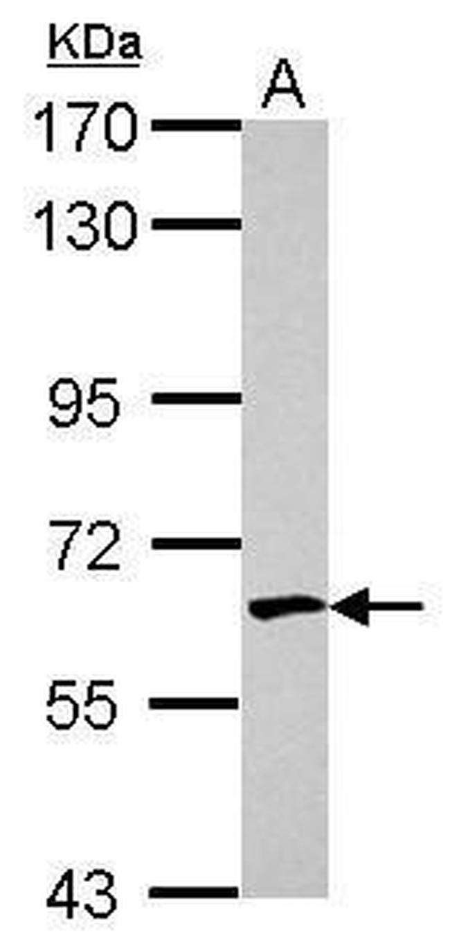 EME1 Antibody in Western Blot (WB)