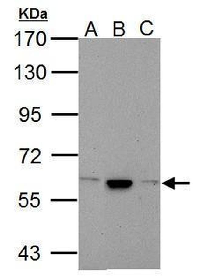 Calcium Channel beta-4 Antibody in Western Blot (WB)