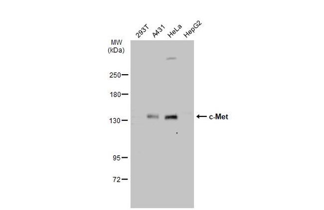 c-Met Antibody in Western Blot (WB)