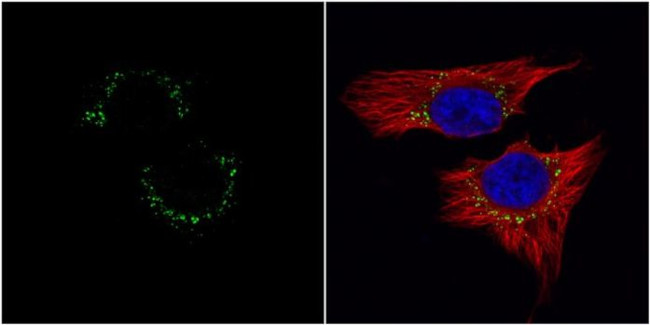 c-Met Antibody in Immunocytochemistry (ICC/IF)