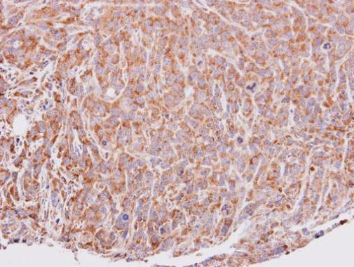 VEGFD Antibody in Immunohistochemistry (Paraffin) (IHC (P))