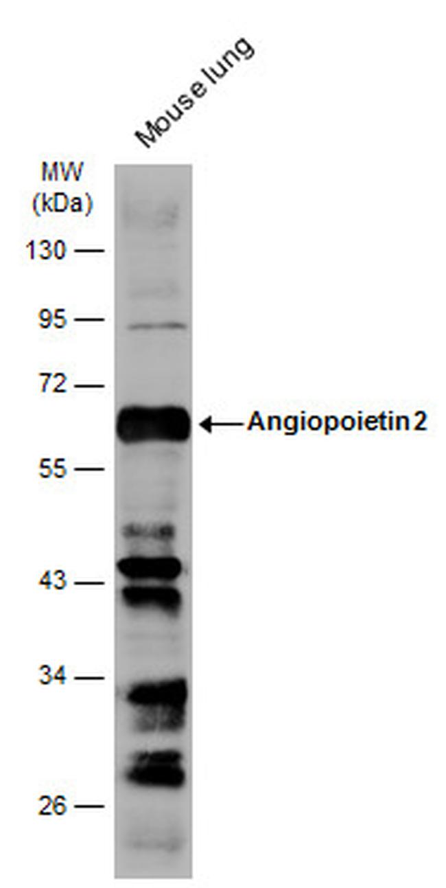 Angiopoietin 2 Antibody in Western Blot (WB)