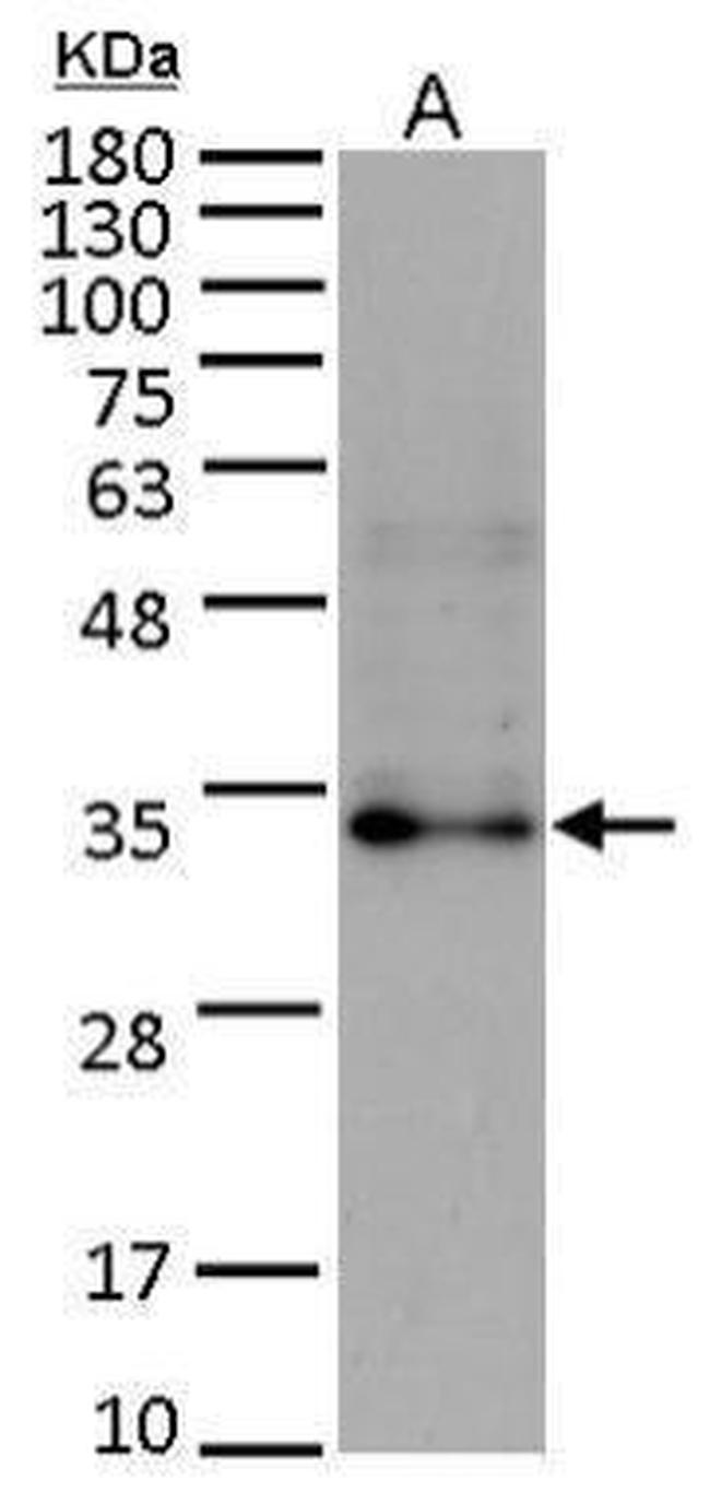 FGF10 Antibody in Western Blot (WB)