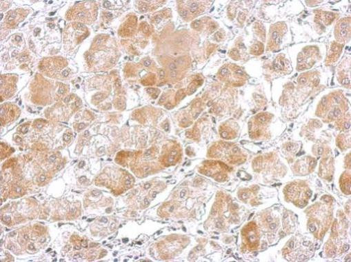 Cytochrome P450 Reductase Antibody in Immunohistochemistry (Paraffin) (IHC (P))