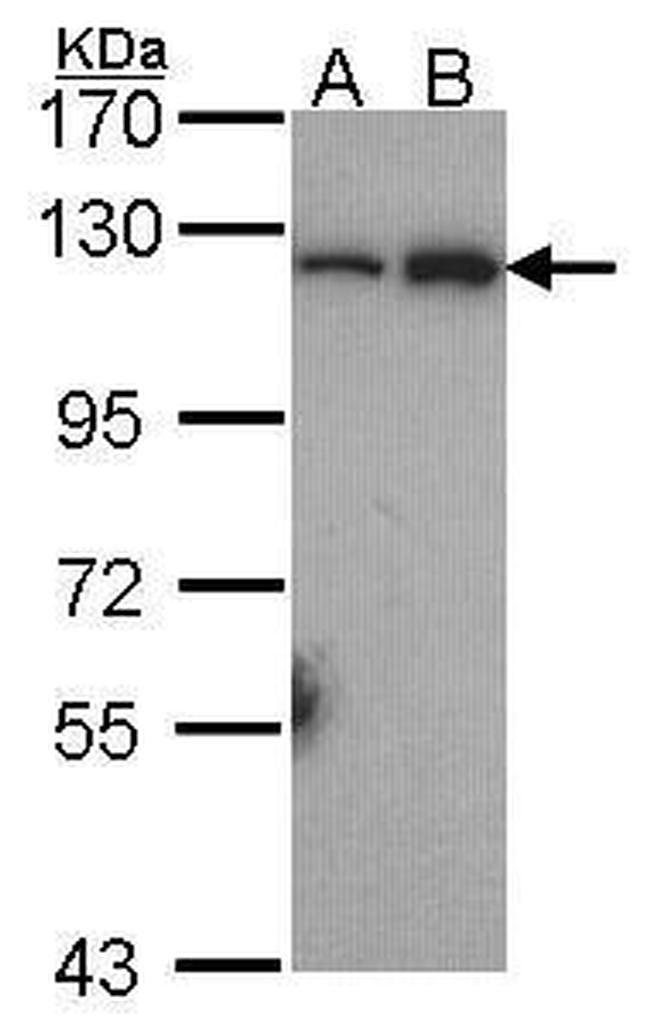 NFkB p100 Antibody in Western Blot (WB)