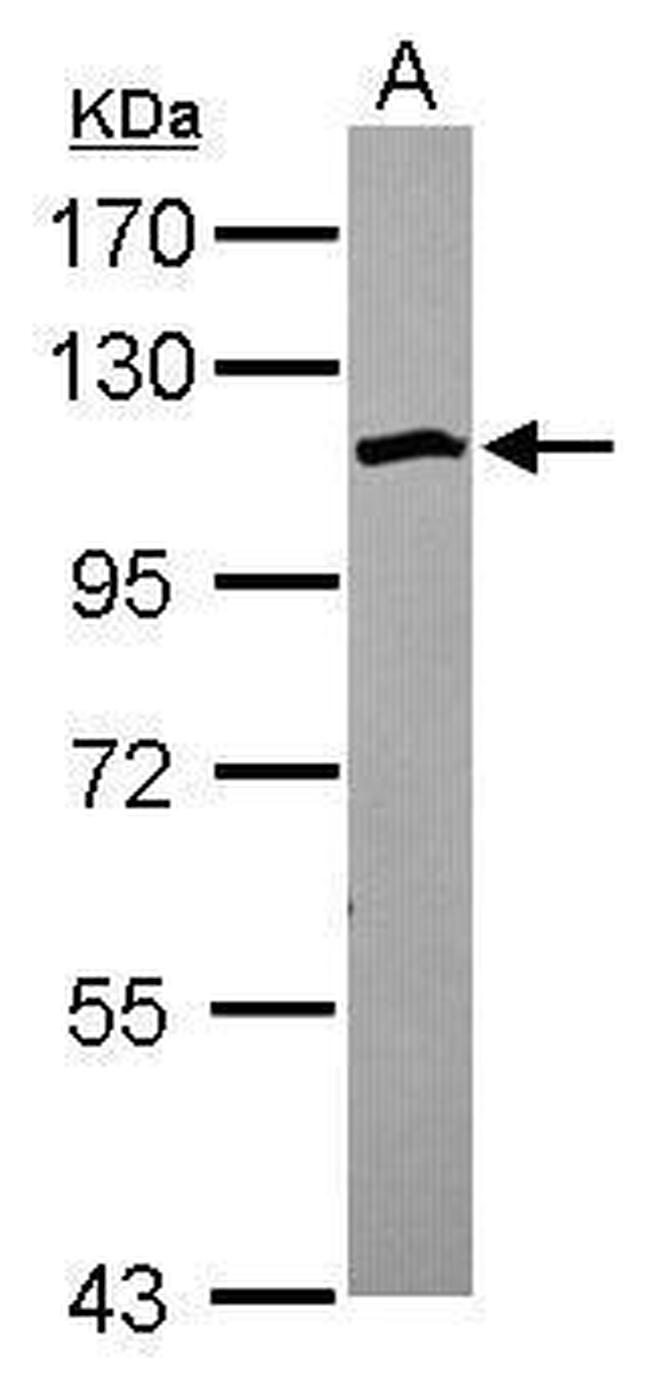 SCP1 Antibody in Western Blot (WB)