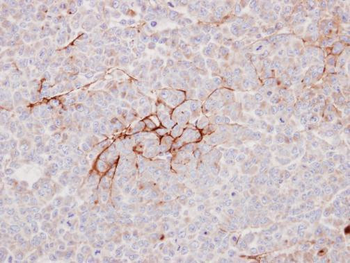 Decorin Antibody in Immunohistochemistry (Paraffin) (IHC (P))