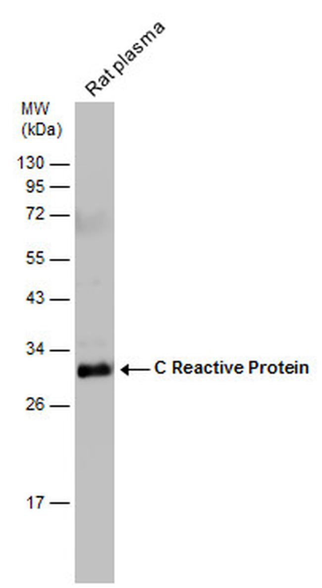 CRP Antibody in Western Blot (WB)