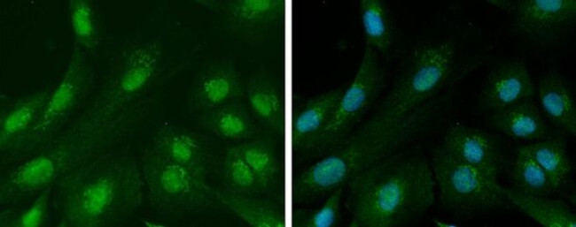 Ataxin 3 Antibody in Immunocytochemistry (ICC/IF)