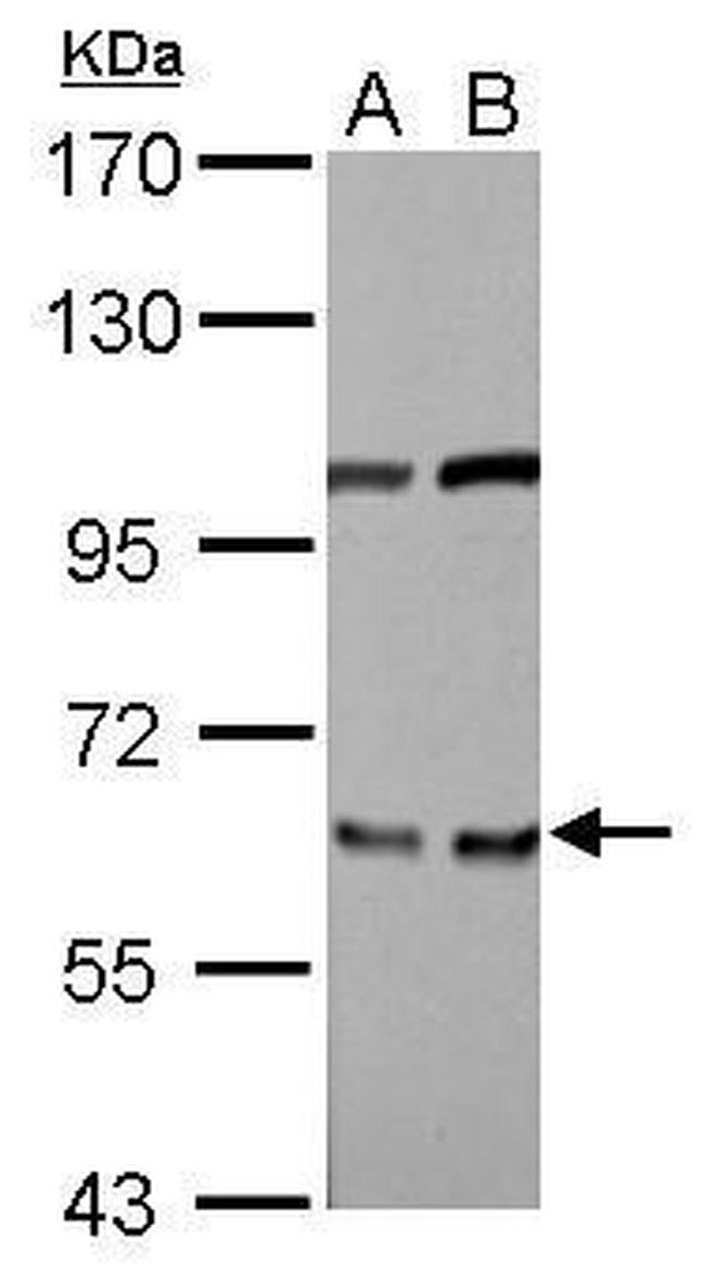 eIF3d Antibody in Western Blot (WB)