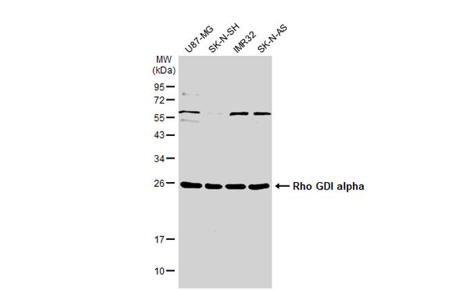 RhoGDI Antibody in Western Blot (WB)