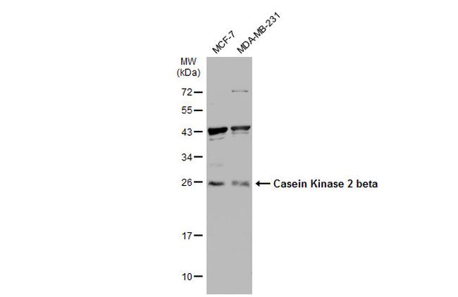 CK2 beta Antibody in Western Blot (WB)