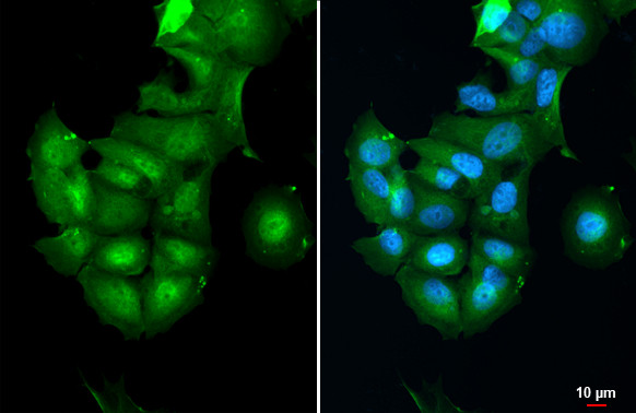 CK2 beta Antibody in Immunocytochemistry (ICC/IF)