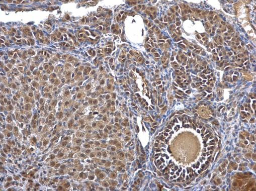 CK2 beta Antibody in Immunohistochemistry (Paraffin) (IHC (P))