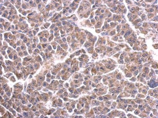 Cytochrome C1 Antibody in Immunohistochemistry (Paraffin) (IHC (P))