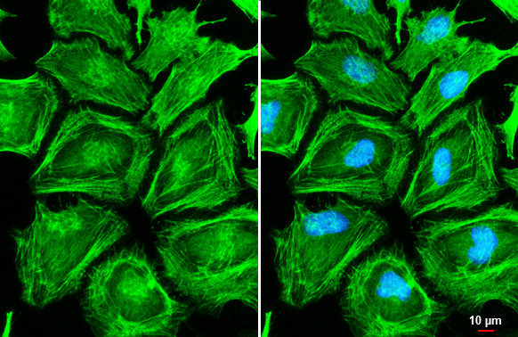 MYH9 Antibody in Immunocytochemistry (ICC/IF)