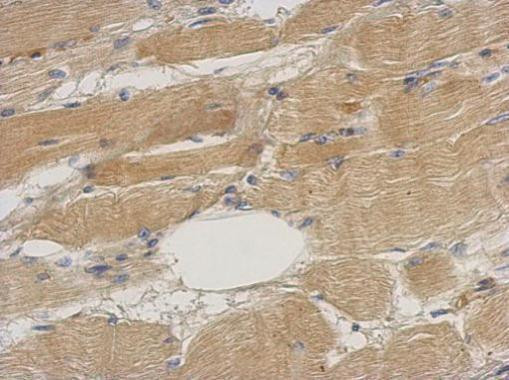 Septin 2 Antibody in Immunohistochemistry (Paraffin) (IHC (P))