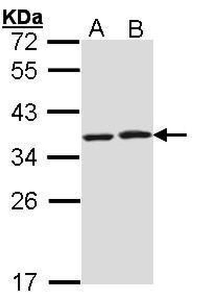 HAX1 Antibody in Western Blot (WB)