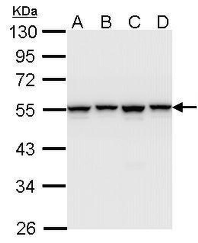 hnRNP H1 Antibody in Western Blot (WB)