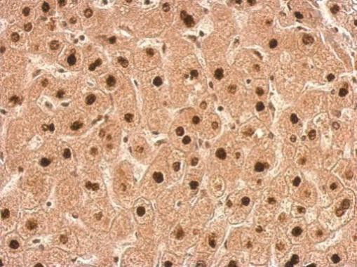 TALDO1 Antibody in Immunohistochemistry (Paraffin) (IHC (P))