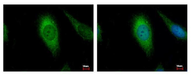 AIF Antibody in Immunocytochemistry (ICC/IF)