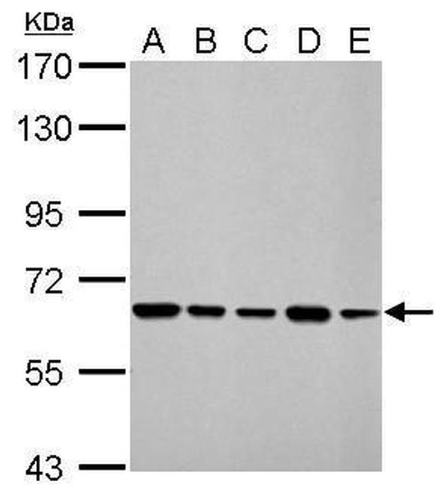 AIF Antibody in Western Blot (WB)