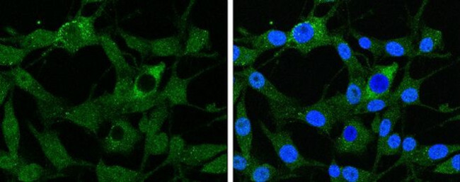 GABBR1 Antibody in Immunocytochemistry (ICC/IF)