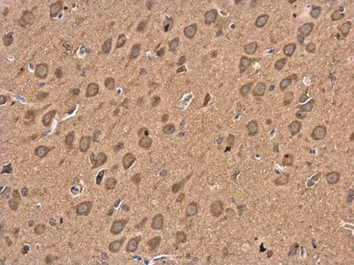 GABBR1 Antibody in Immunohistochemistry (Paraffin) (IHC (P))