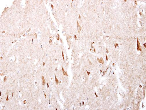 GABBR1 Antibody in Immunohistochemistry (Paraffin) (IHC (P))