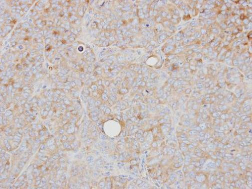 PRPS1 Antibody in Immunohistochemistry (Paraffin) (IHC (P))