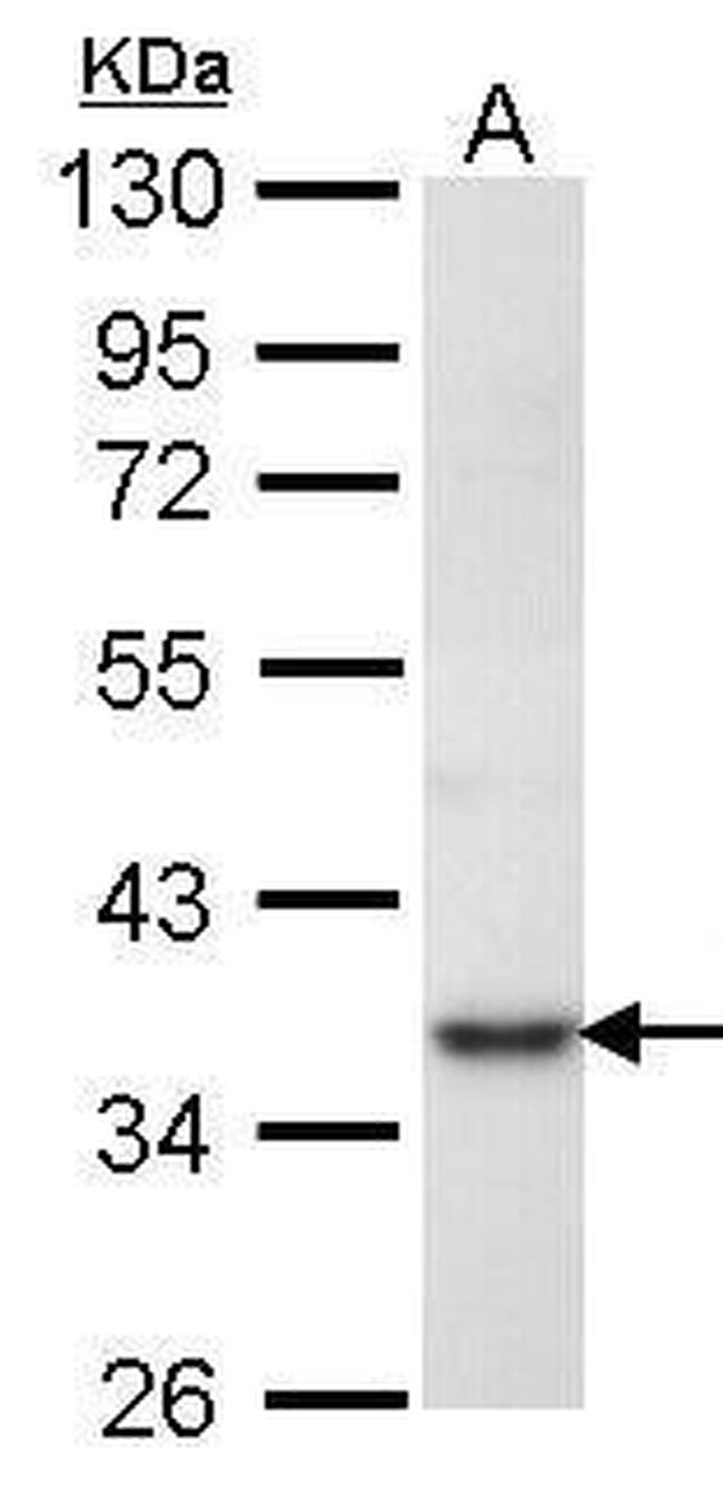 PRPS1 Antibody in Western Blot (WB)