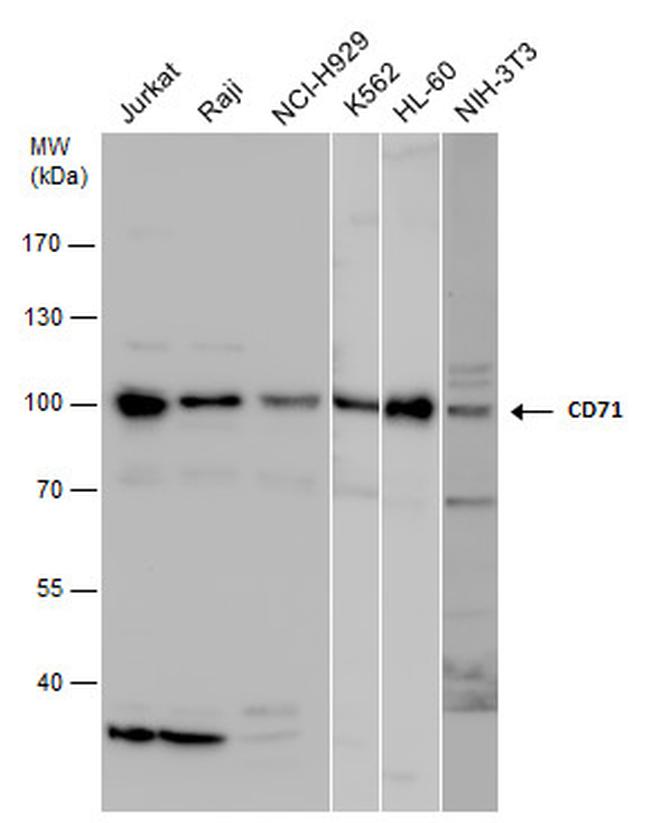 Transferrin Receptor Antibody in Western Blot (WB)